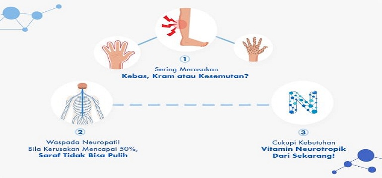 Cara Mengatasi Kebas Karena Kebas Bisa Di Rasakan Oleh Siapa Saja