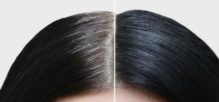 Cara Ampuh Merawat Rambut Agar Uban Tak Lagi Menghantui! Inilah Rahasianya