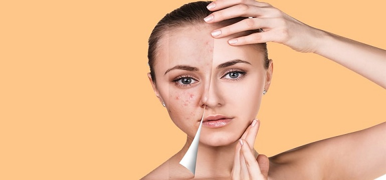 Trend Bisnis Kecantikan yang Di Gandrungi Wanita Jaman Now