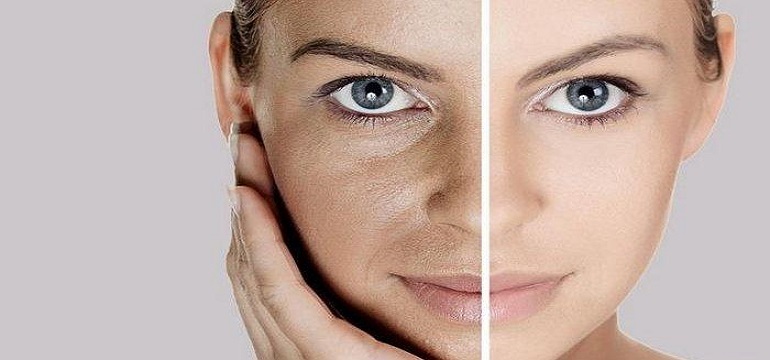 Cara Mengatasi Kulit Kering Agar Menjadi Glowing